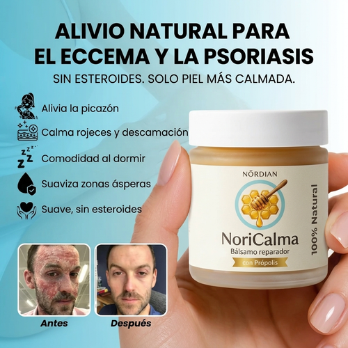 NoriCalma - Bálsamo reparador para el eccema y la psoriasis